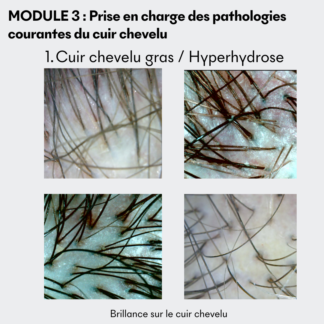 Formation : Initiation à la trichologie