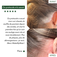 Complément SOS Plaques Sèches