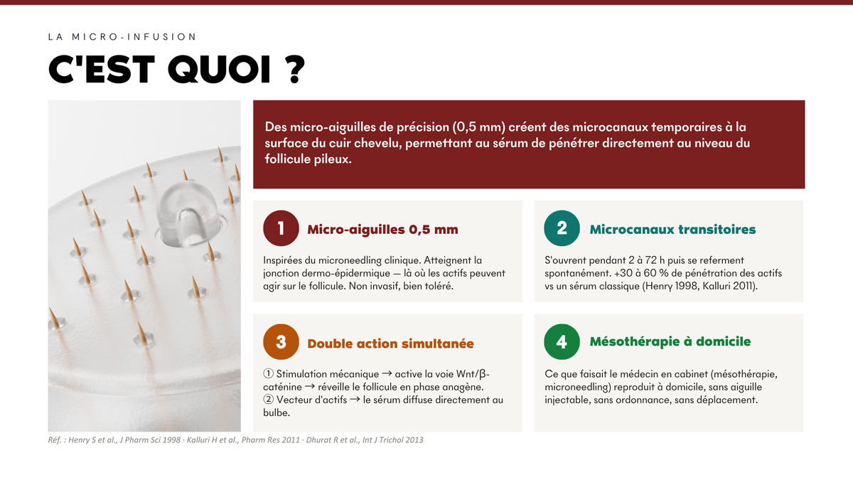 Avis