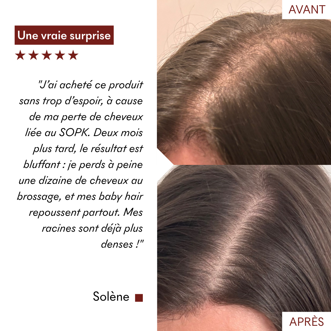Sérum Anti-Chute Tricho-Boost
