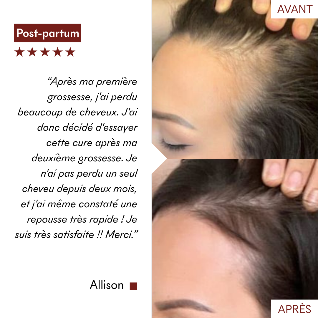 anti_chute_avant_apres_makemymask (3).png__PID:e7e345c2-1535-4169-b8ec-07f7fd4d2c8b