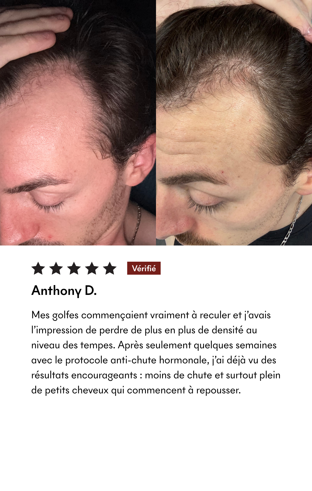 Avis