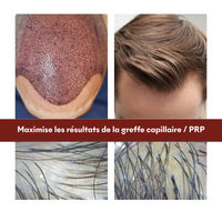 Mallette Post-Greffe capillaire/PRP