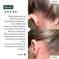 Masques Anti-Pelliculaires en poudre