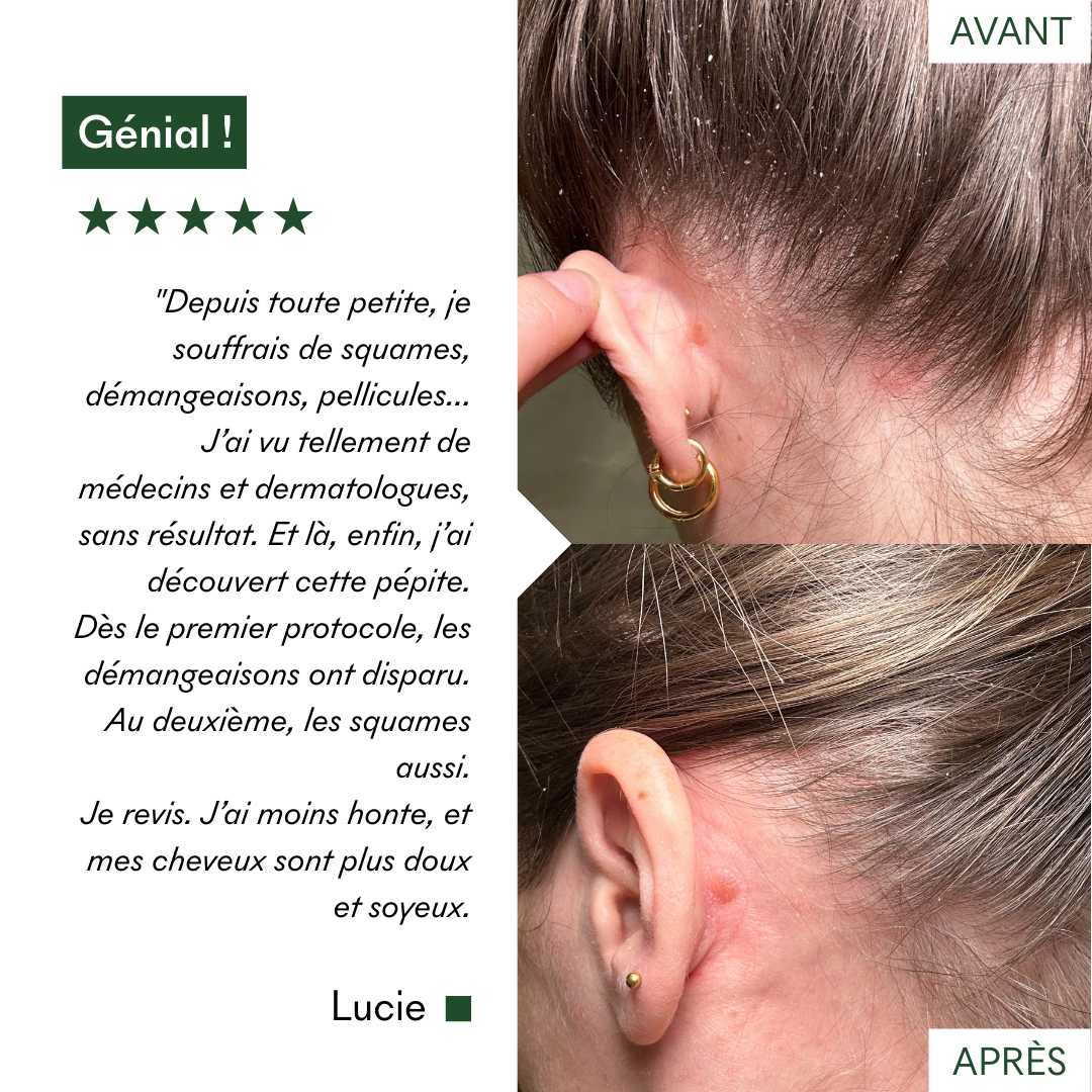 Avis