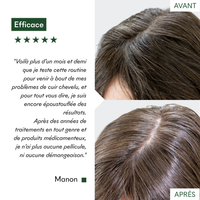 Masques Anti-Pelliculaires en poudre