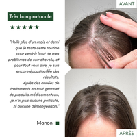Masques Anti-Pelliculaires en poudre