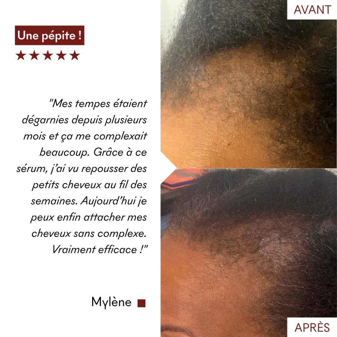 Avis