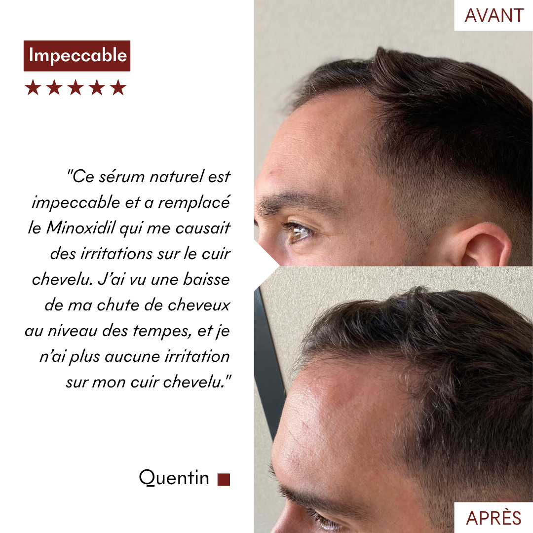 Sérum Anti-Chute Tricho-Boost